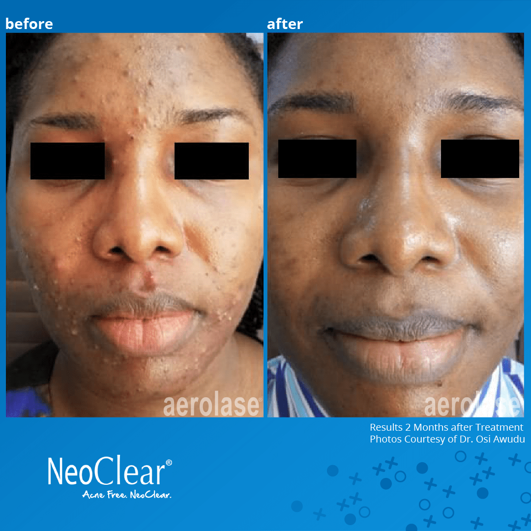 Before and After-dr.osi awudu-blue-bg